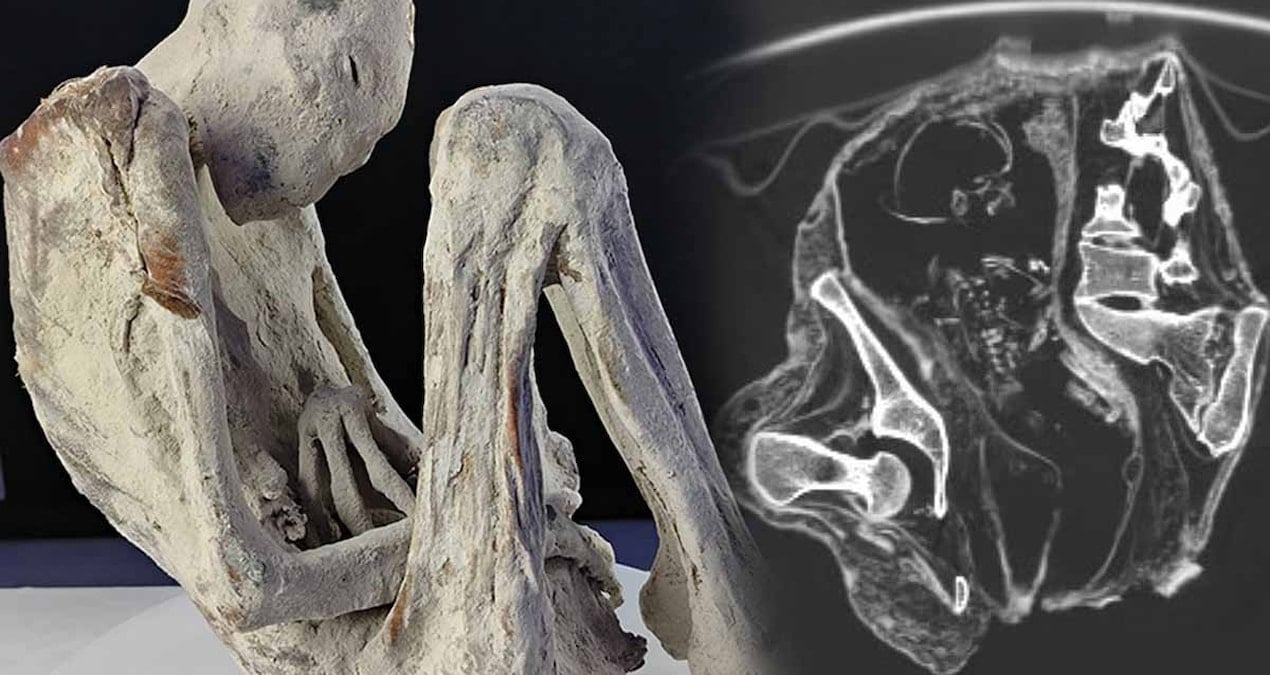 Bilim insanları, 1.200 yıllık mumyalanmış bir bedenin rahminde çarpıcı bir keşifte bulundu