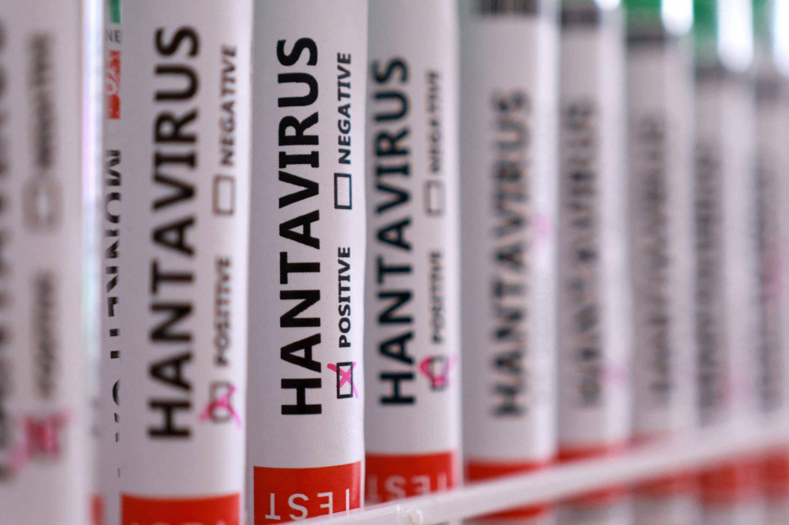 Hantavirüs iddialarına ilişkin bakanlık açıklaması